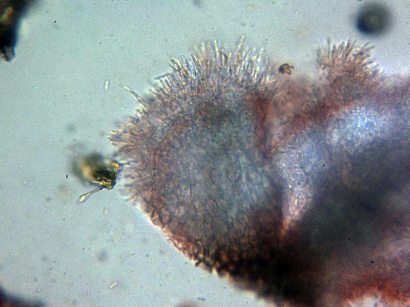 Cytospora paratranslucens 13 - Sección himenio x 400